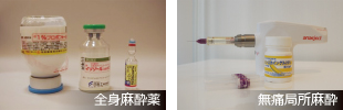 静脈麻酔薬と歯科用局所麻酔薬 静脈麻酔薬と歯科用局所麻酔薬