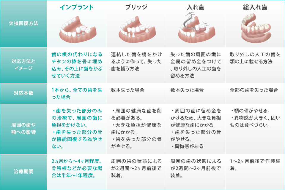 インプラントの優位性 インプラントの優位性